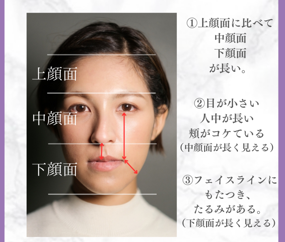 美容整形で「面長顔」「老け顔」を治療する方法