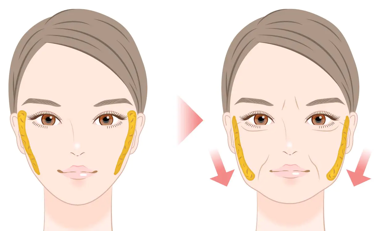 クイーンリフト