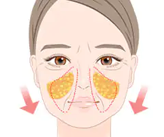 メーラーファット除去