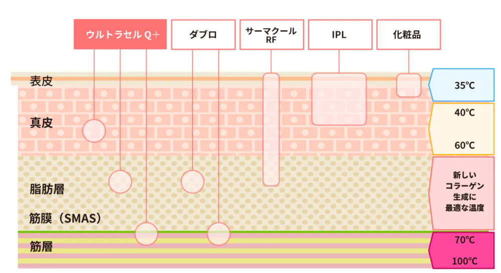皮膚の土台SMAS筋膜・目尻小じわにもにアプローチ