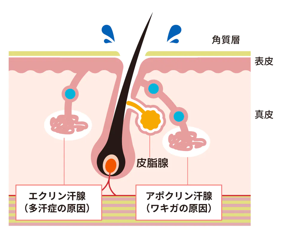 知っていますか？気になるワキ汗・汗ジミ